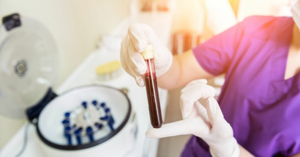 Platelet-Rich Plasma