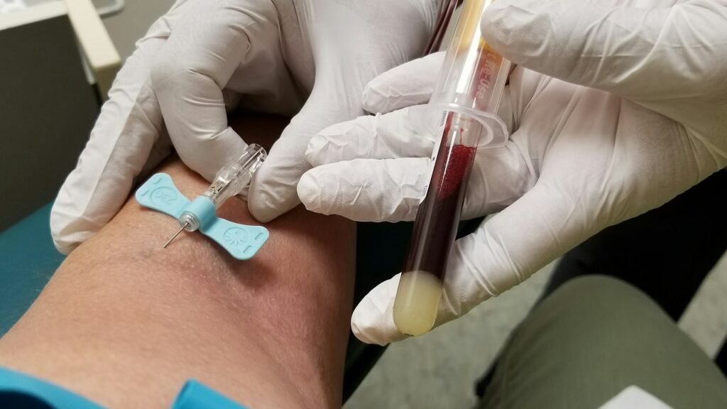 Phlebotomy!
